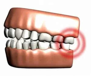 Jaw pain due to TMD can be relieved with TMJ treatment in Elgin, IL.