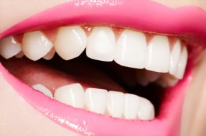 What You Need To Know About Teeth Whitening In St Charles IL   