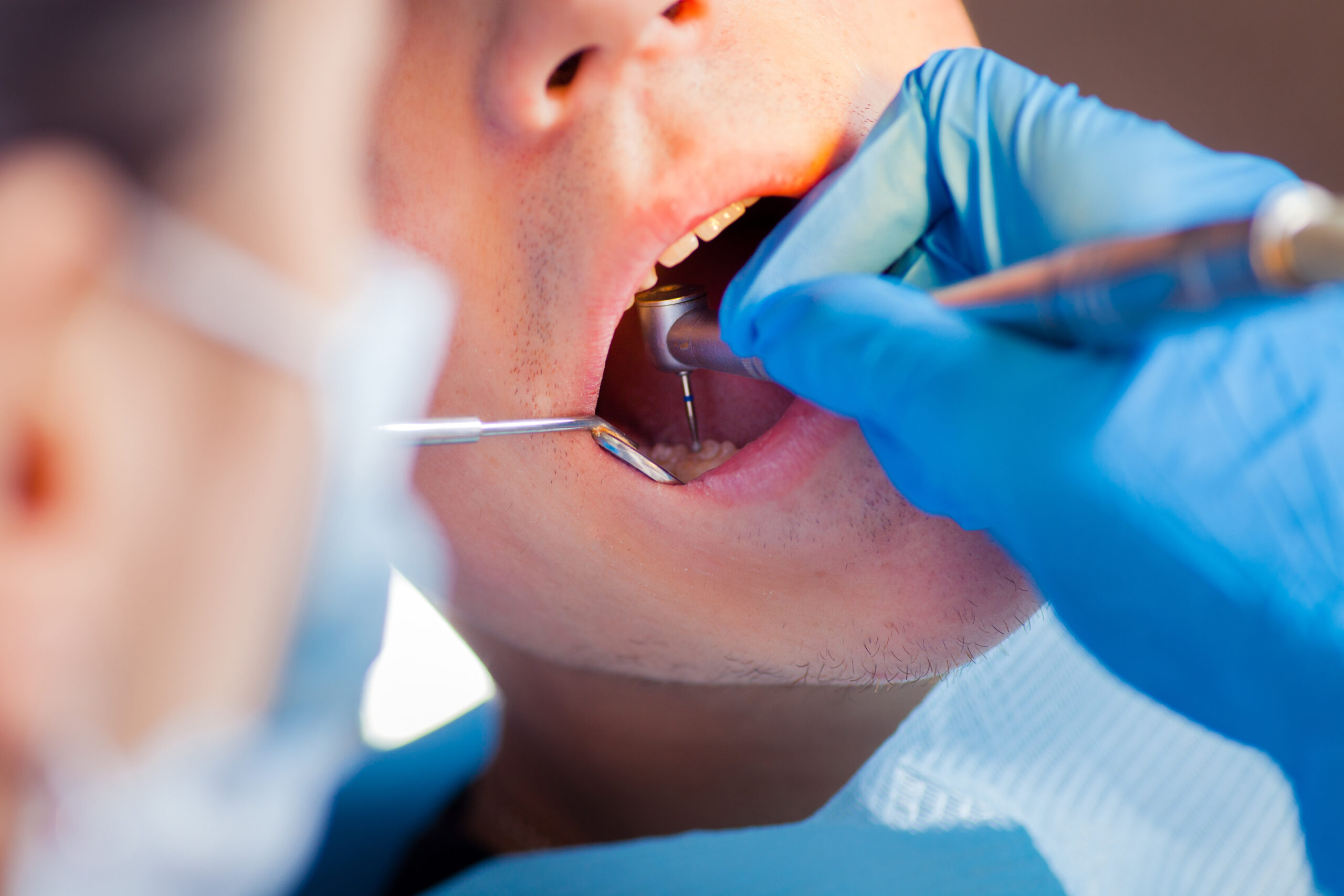 dentist looking into a patients mouth, checking for signs of infected tooth