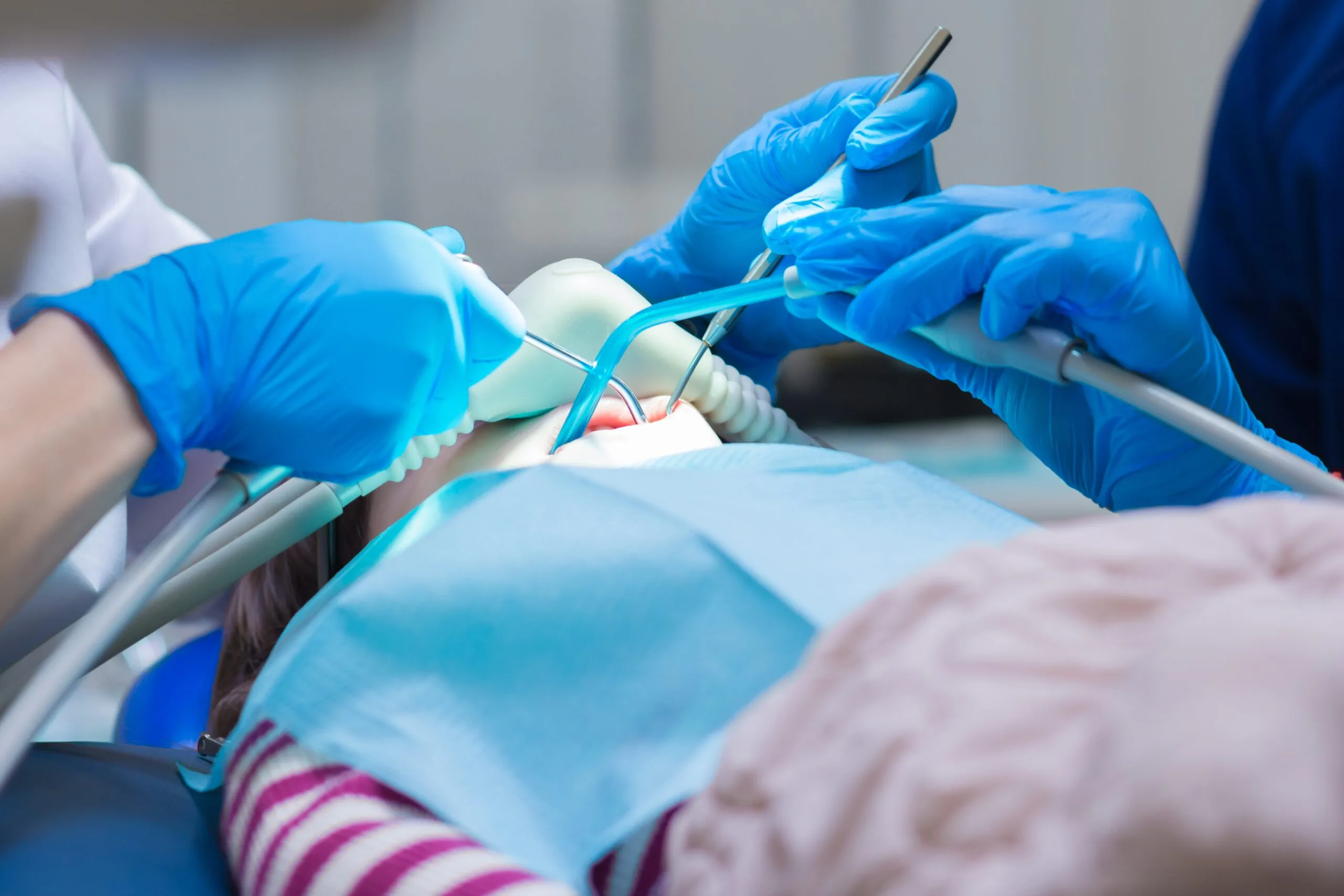 dentist in blue gloves using sedation during a dental treatment