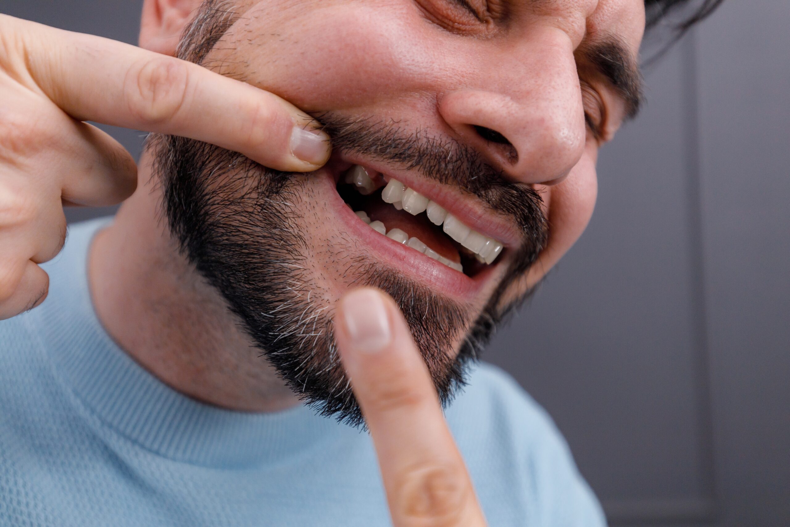 closeup of a man smiling, showing gap in smile, missing teeth